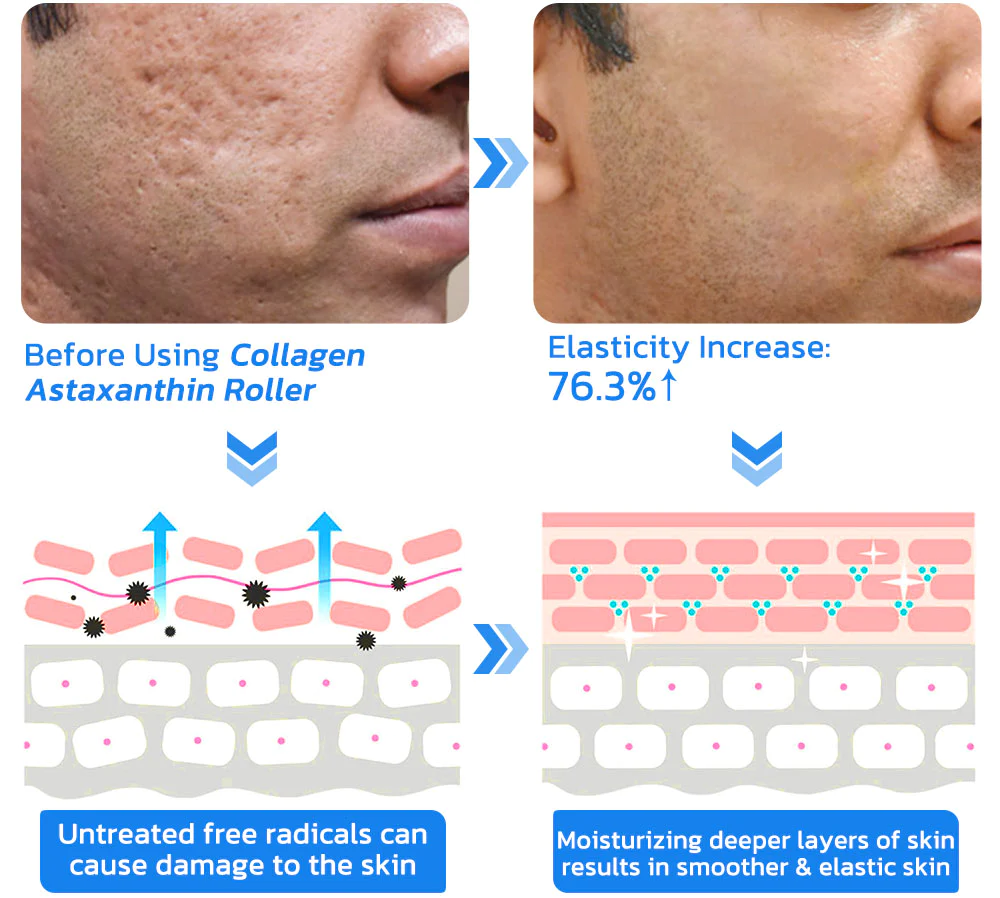 flysmus BoLiftox PockmarksTreat Collagen Astaxanthin Roller