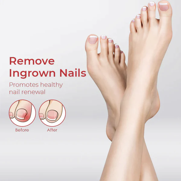 NailPro Anti Paronychia Relief Oil