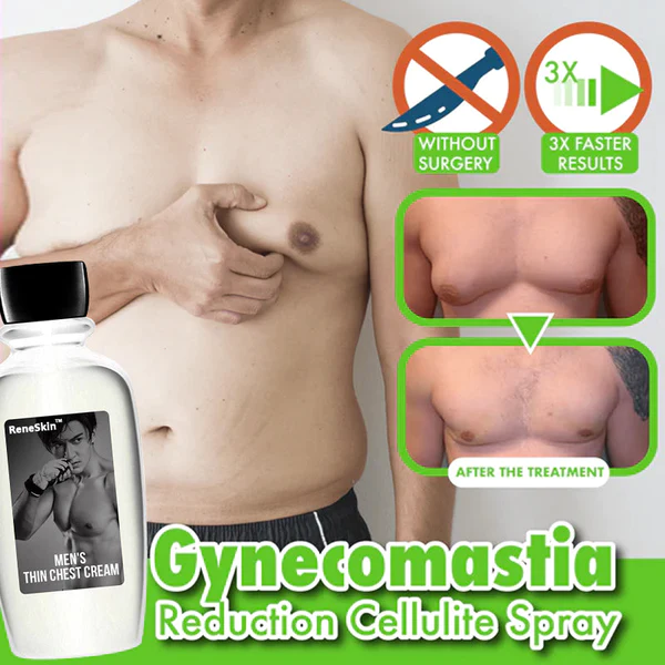 ReneSkin Gynecomastia Reduction Cellulite Cream