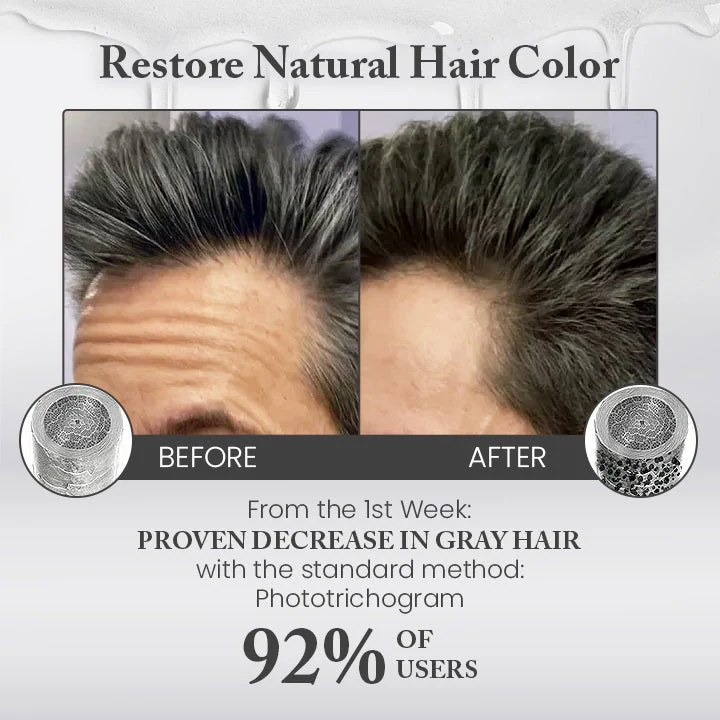 Ceoerty Anti-Gray Hair Serum