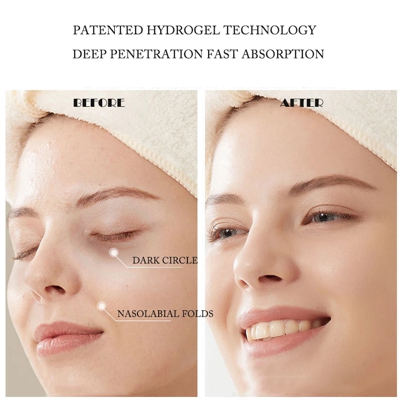 Hyaluronic Acid Microcrystalline Lifting Decree Patch