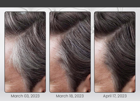 Ceoerty Anti-Gray Hair Serum