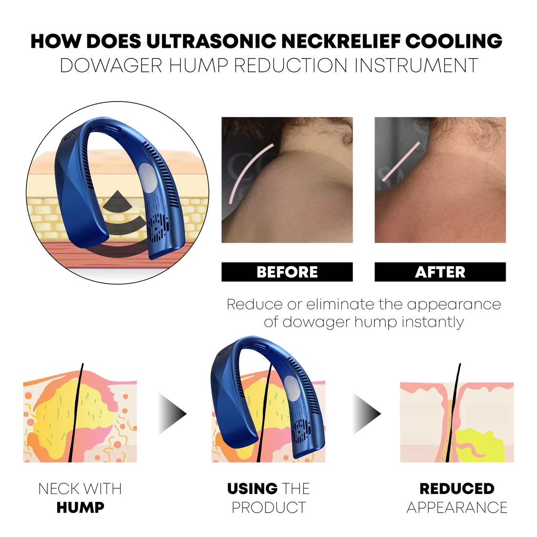 Ricpind Ultrasonic NeckRelief Cooling Instrument