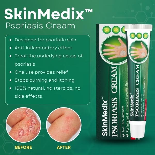 S.Medix Psoriasis Cream