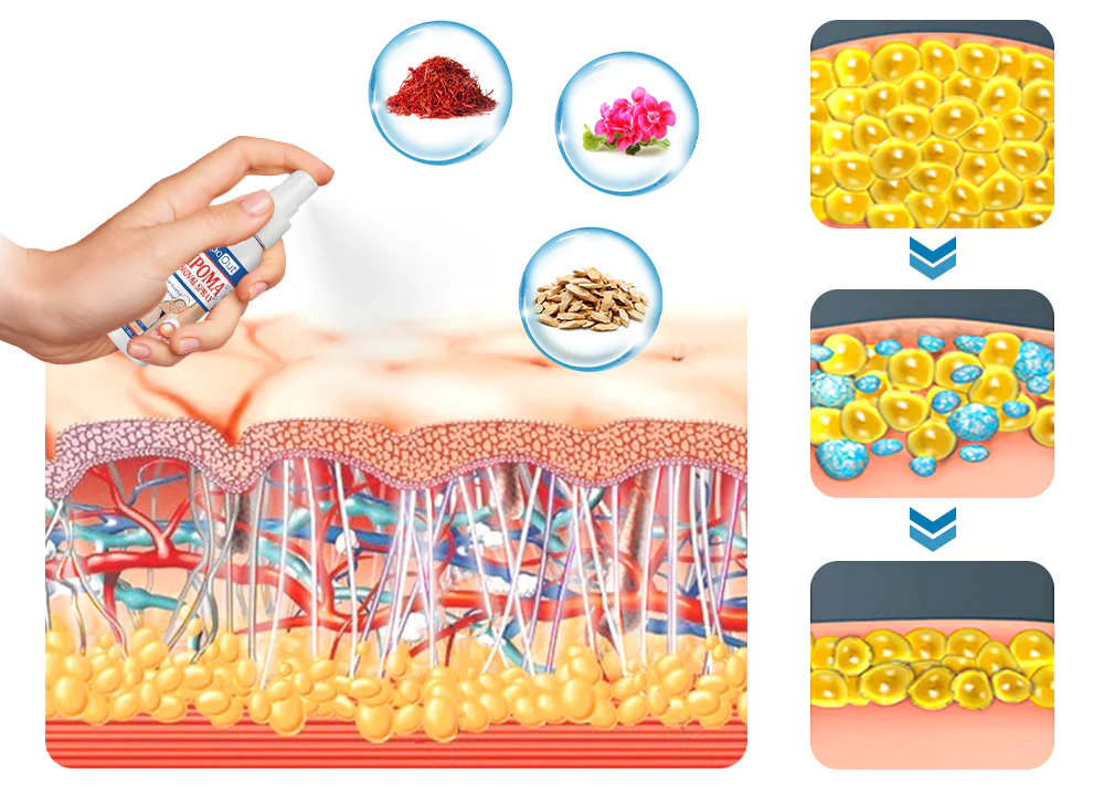 LipoOut Lipomheilung Reduction Spray