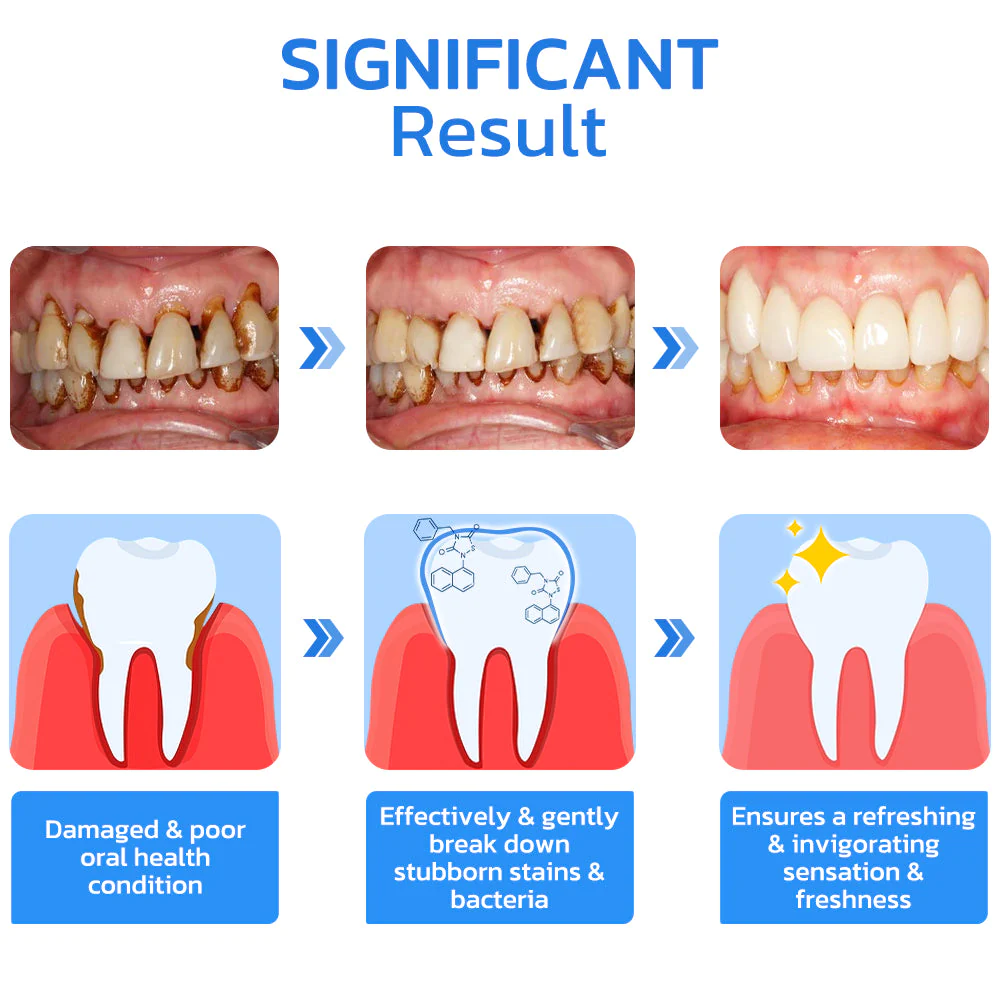 GFOUK Gum Repair Strips