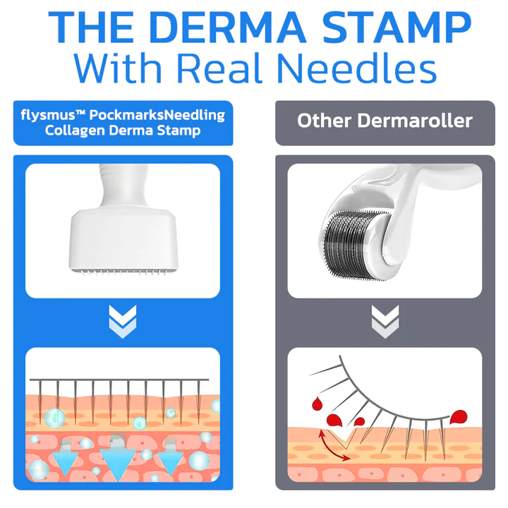 flysmus PockmarksNeedling Collagen Derma Stamp