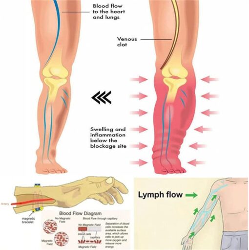 Lymph Detox Magnetic Bracelet