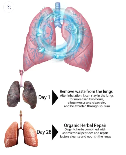 MEDix Herbal Lung Cleanse Spray