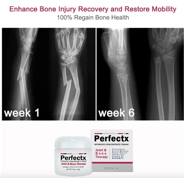 GFOUK Perfectx Joint and Bone Recovery Cream