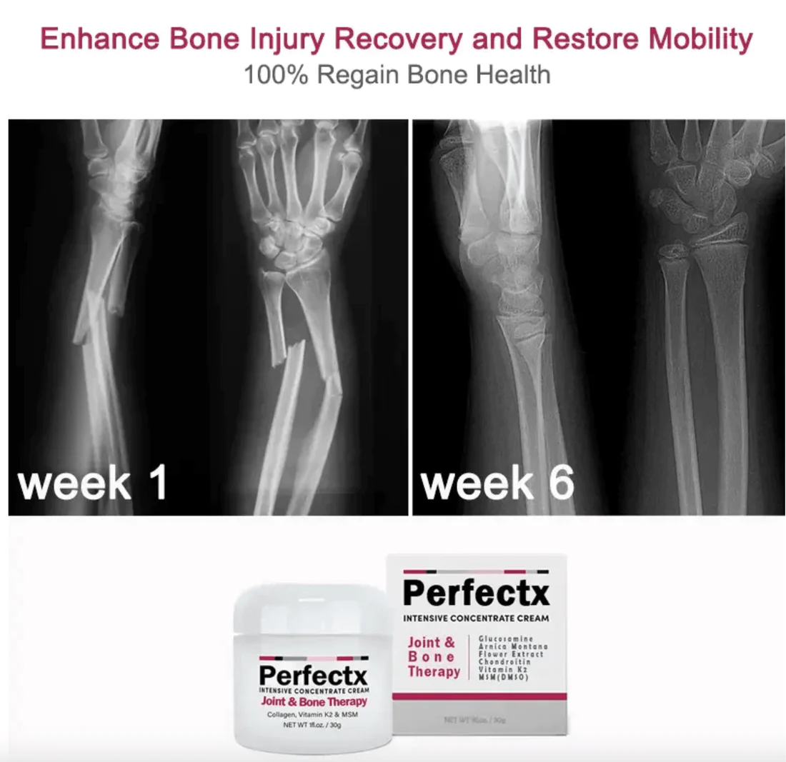 GFOUK Perfectx Joint And Bone Therapy Cream