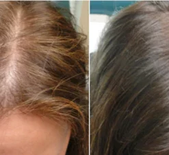 InstaGrow Hair Growth Ginger Cream