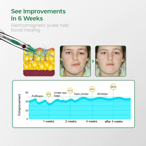 ProSculpt EMS Facial Toning Duo Device