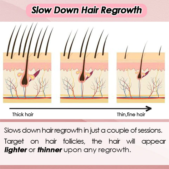 Silky Soft Skin Hair Remover