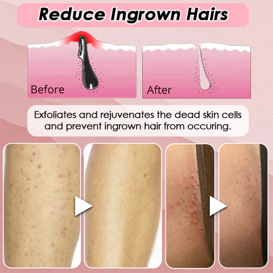 Silky Soft Skin Hair Remover