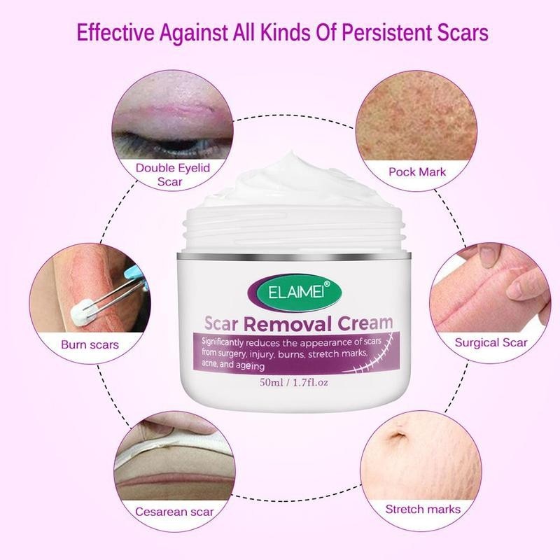 Intensive Scar Removal Cream