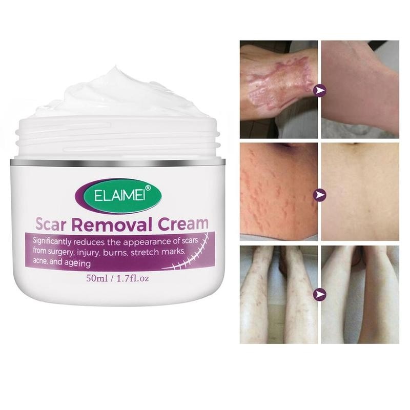 Intensive Scar Removal Cream