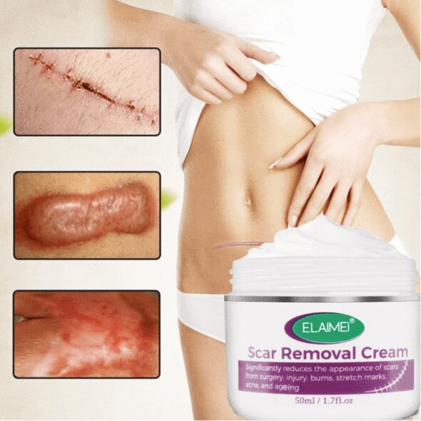 Intensive Scar Removal Cream