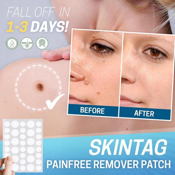 Skin Tag Pain-Free Remover Patch