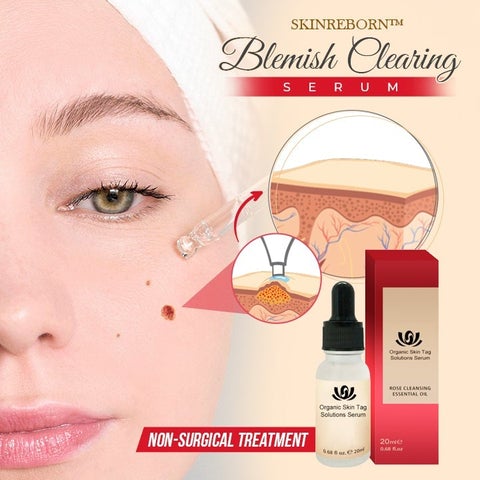 SkinReborn Blemish Clearing Serum