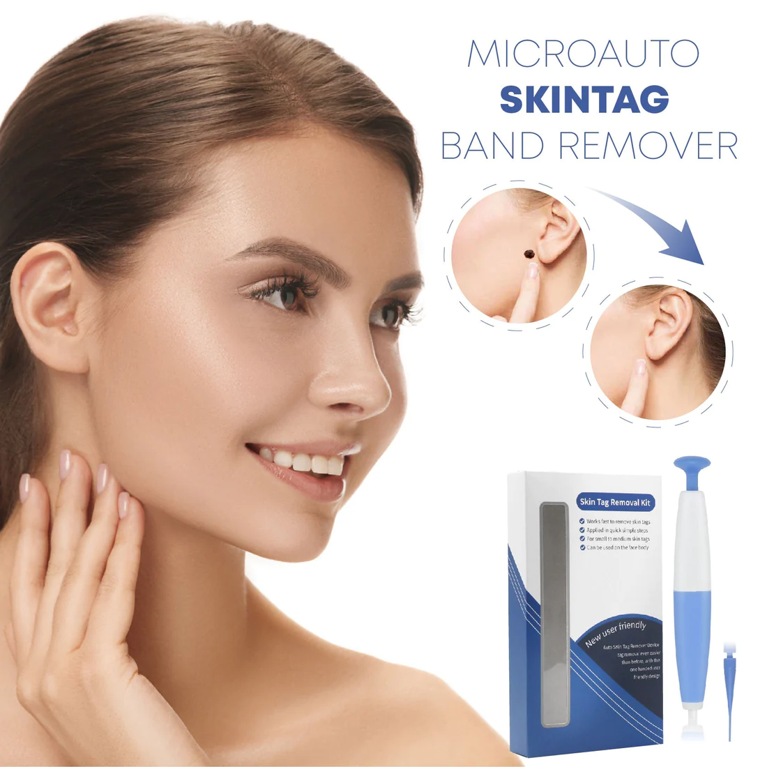 MicroAuto SkinTag Band Remover