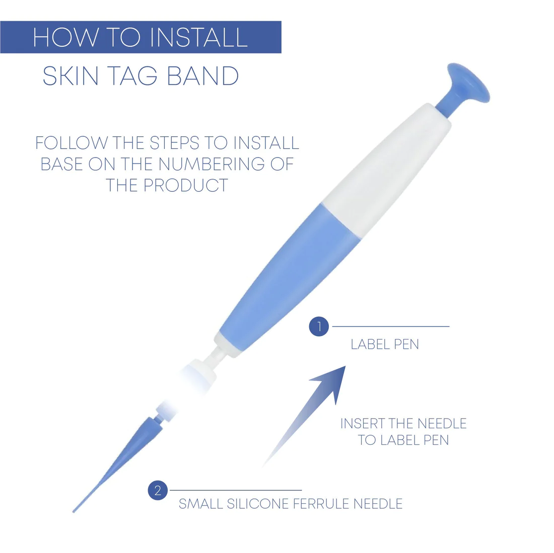 MicroAuto SkinTag Band Remover