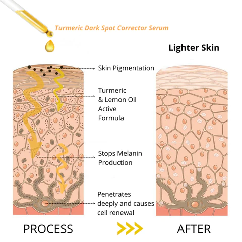 SkinFx Turmeric Dark Spot Corrector Serum