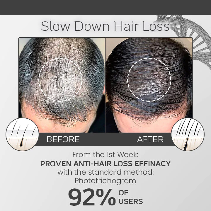 Ceoerty LocksGuard Anti-Hairloss Spray