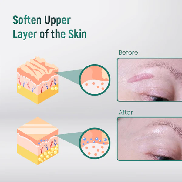 ScarXpert Advanced Scar Removal Gel