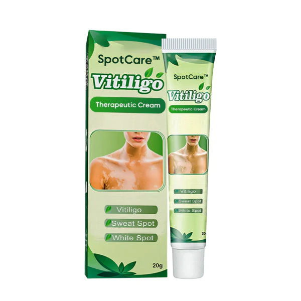 SpotCare Vitiligo Therapeutic Cream