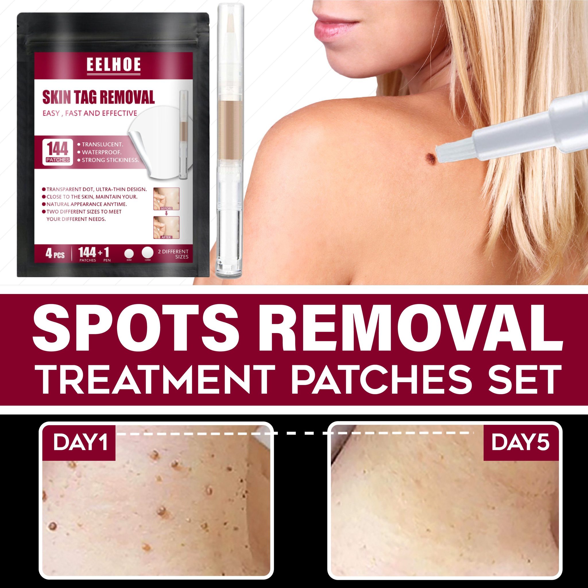 Spots Removal Treatment Patches Set