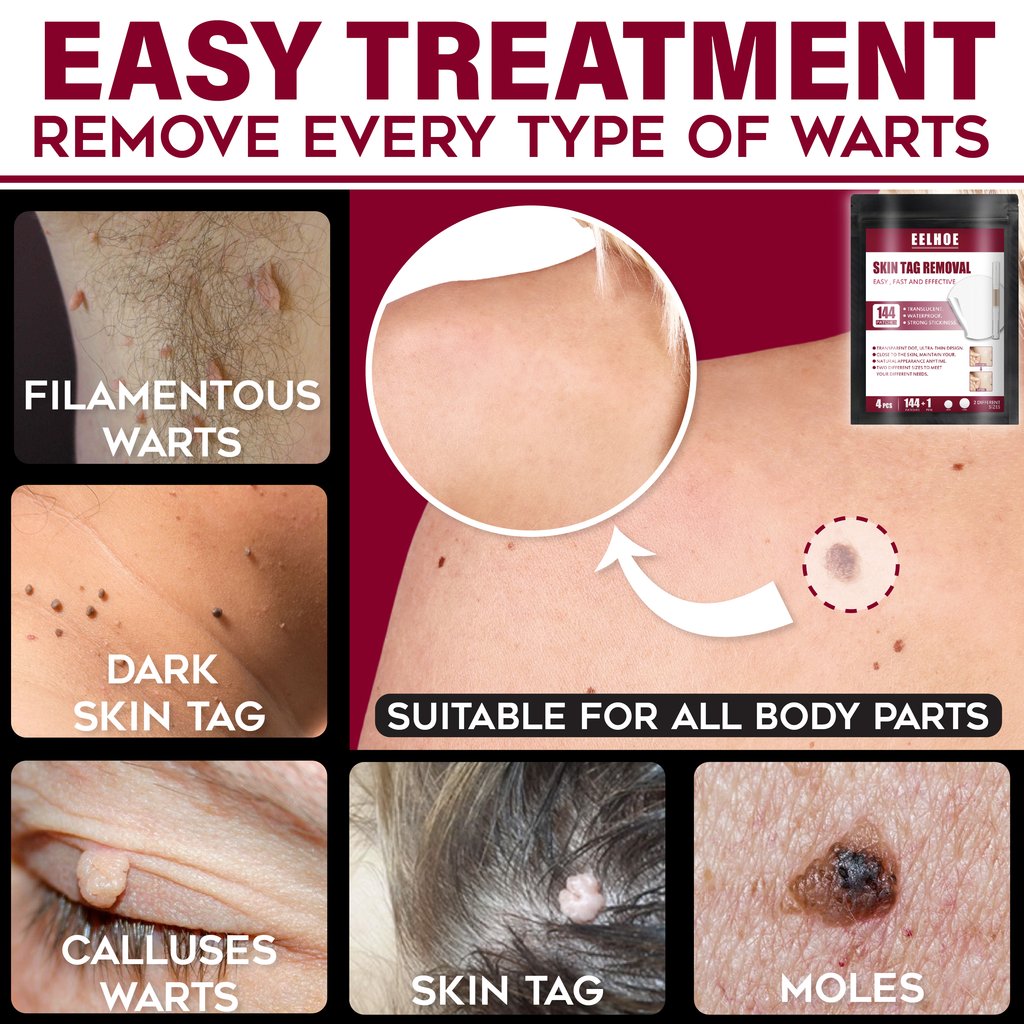 Spots Removal Treatment Patches Set