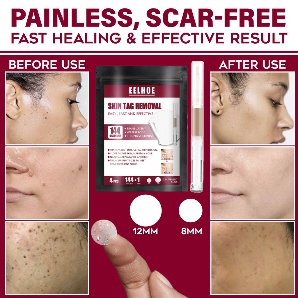 Spots Removal Treatment Patches Set