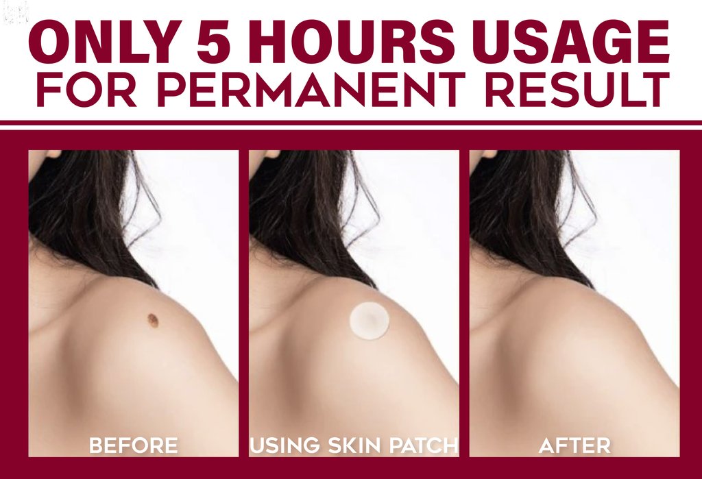 Spots Removal Treatment Patches Set