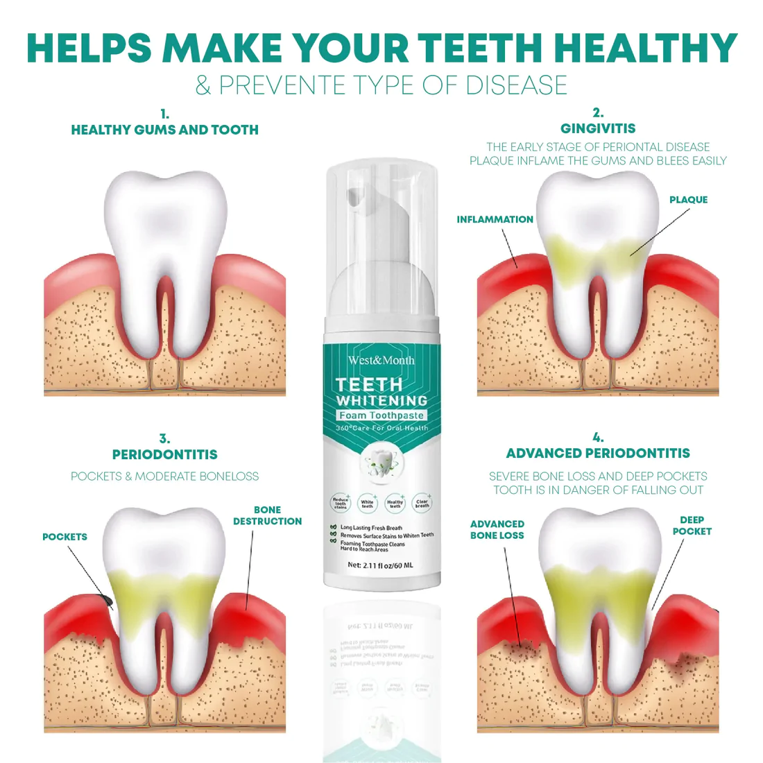 StainOff TeethWhitening Mousse Toothpaste