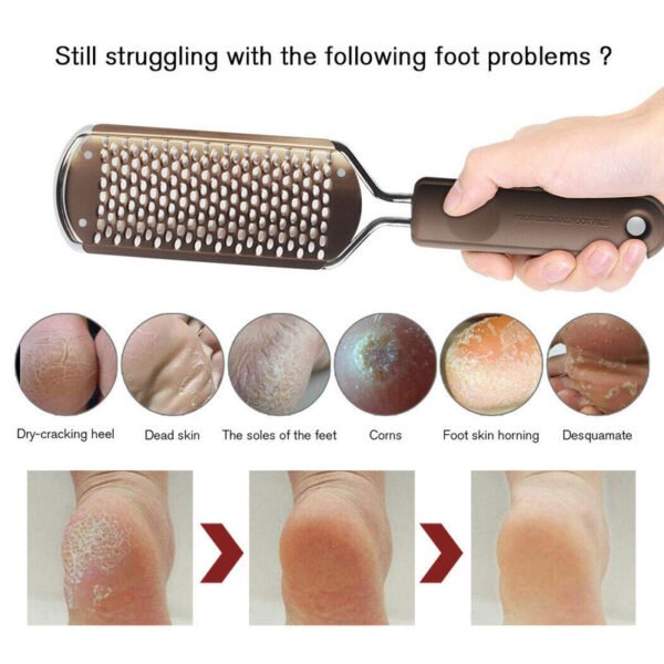 Feet Callus Safe Eliminator