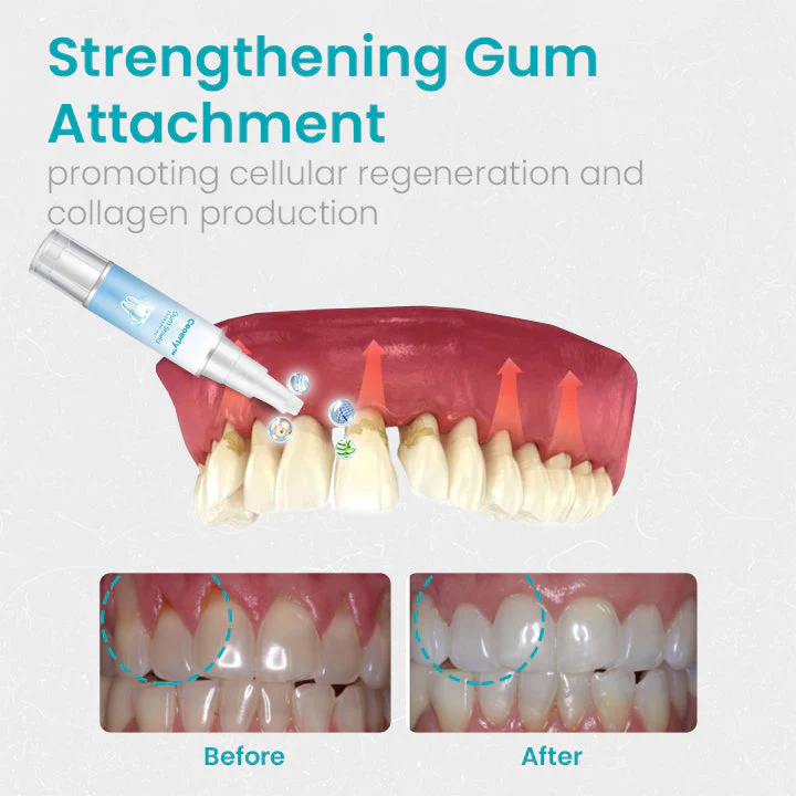 Oveallgo Gum Shield Therapy Gel