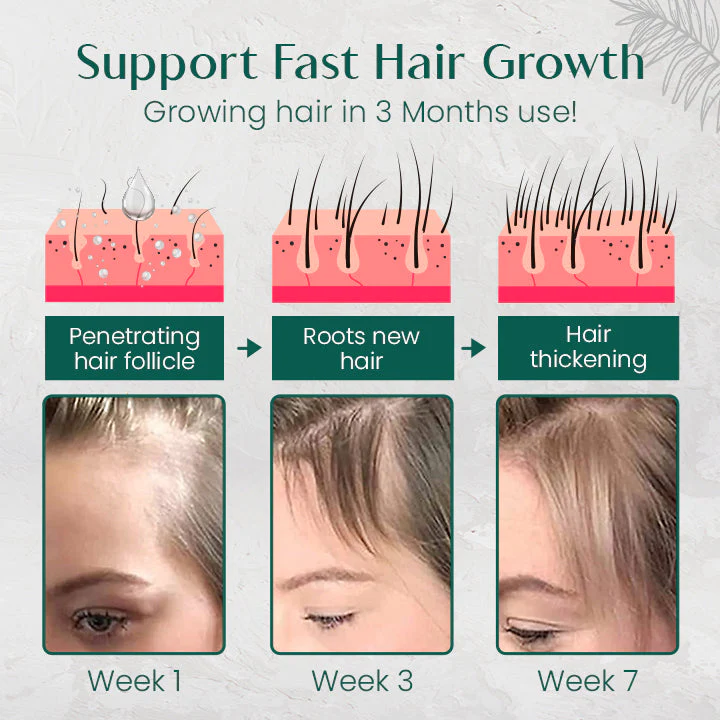 Ceoerty HairRenew Pro Growth Serum