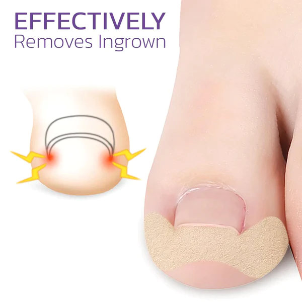 Japanese Elastic Toenail Correction Patch