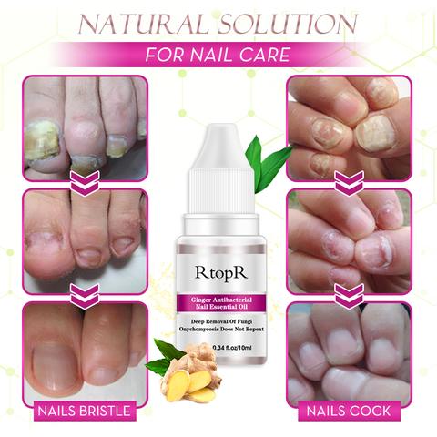 Ginger Health Toe Repair Treatment Gel