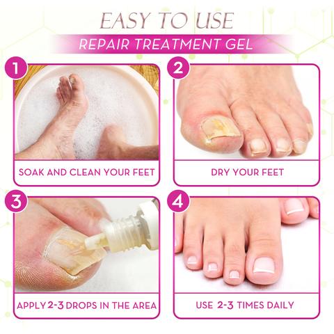 Ginger Health Toe Repair Treatment Gel