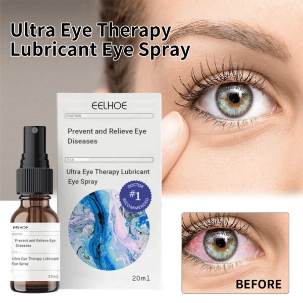 Oveallgo EYELIGHT Ultra Eye Therapy Lubricant Eye Drops