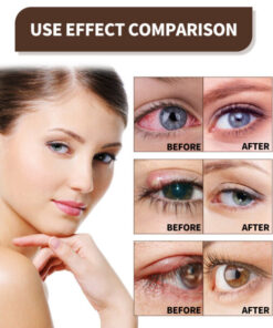 Oveallgo EYELIGHT Ultra Eye Therapy Lubricant Eye Drops