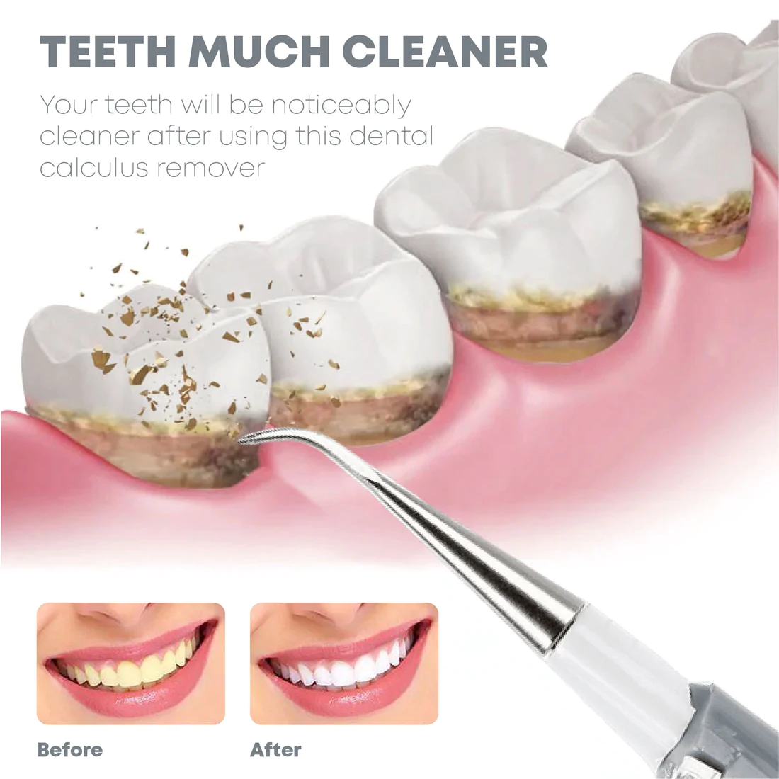 TeethWhitener Ultrasonic Vibration Cleaner