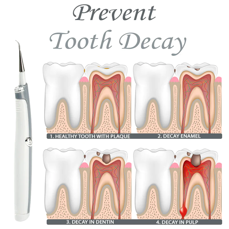 TeethWhitener Ultrasonic Vibration Cleaner