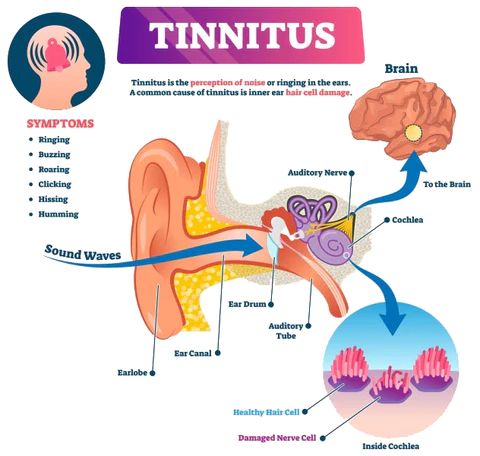 TinnitusRelief Ear Care Patch