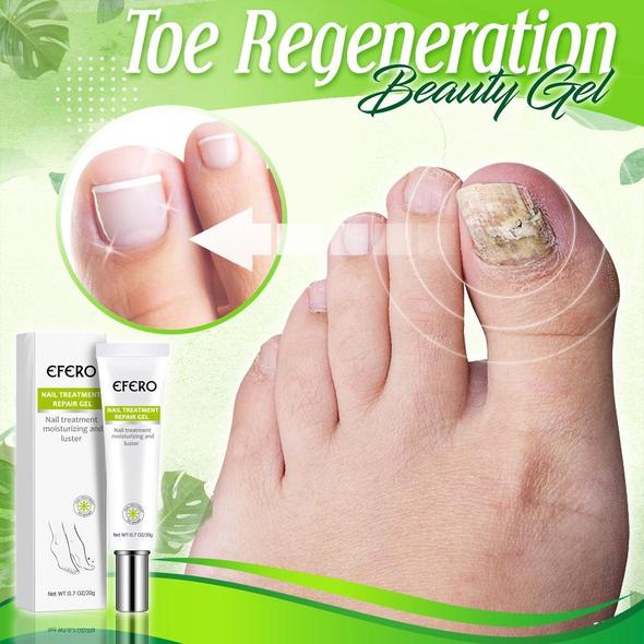 Toe Regeneration Beauty Gel