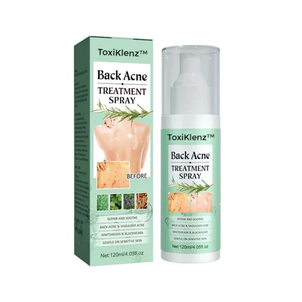 ToxiKlenz Back Acne Treatment Spray