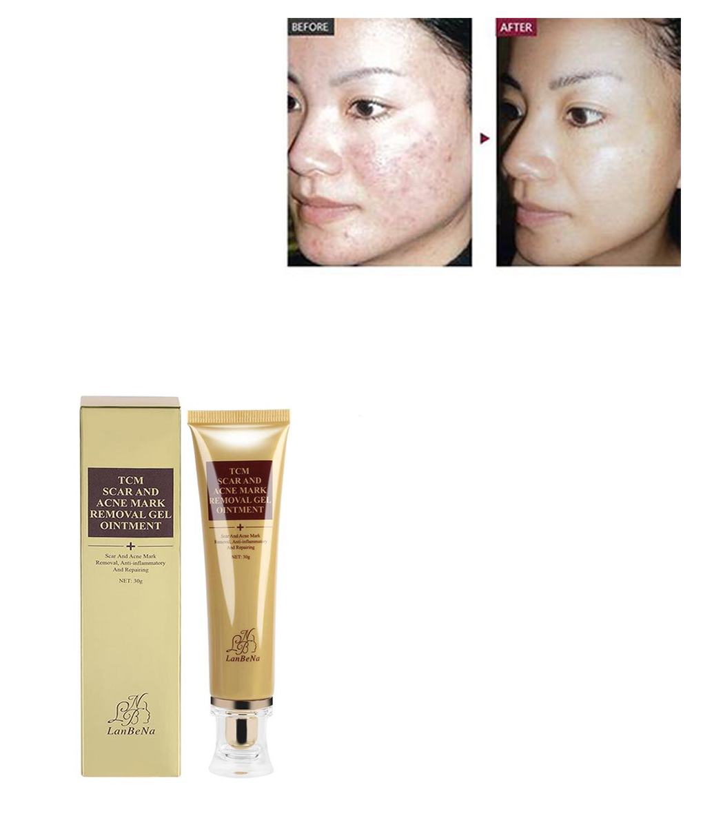 Acne Scar Remover Cream