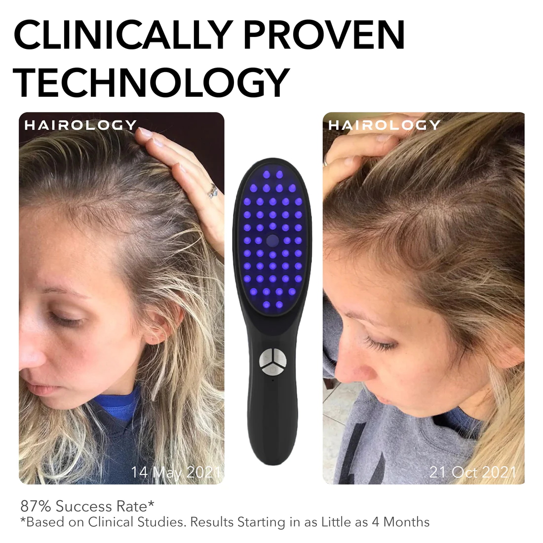 EMS Hairology Strength Cure Laser Comb